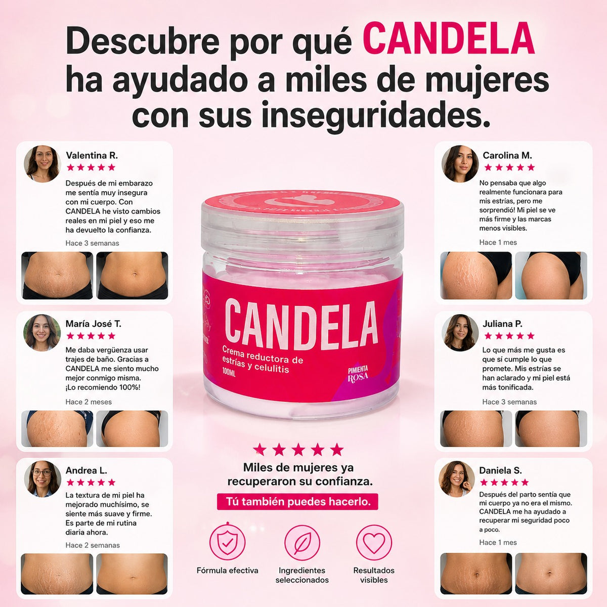 CANDELA CREMA: Mejora la apariencia de estrías visibles