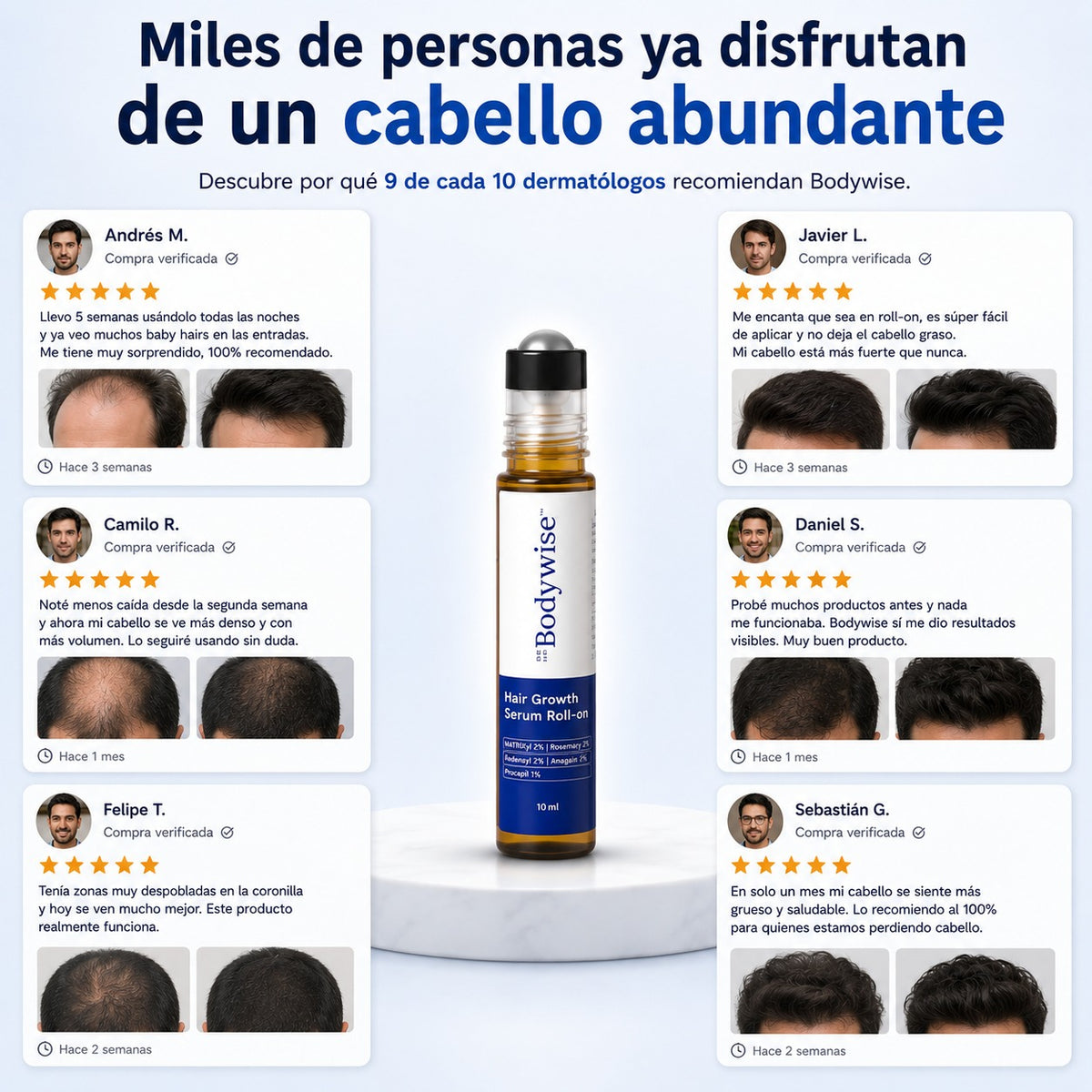 BODYWISE: Recupera esa seguridad que la calvicie te robo
