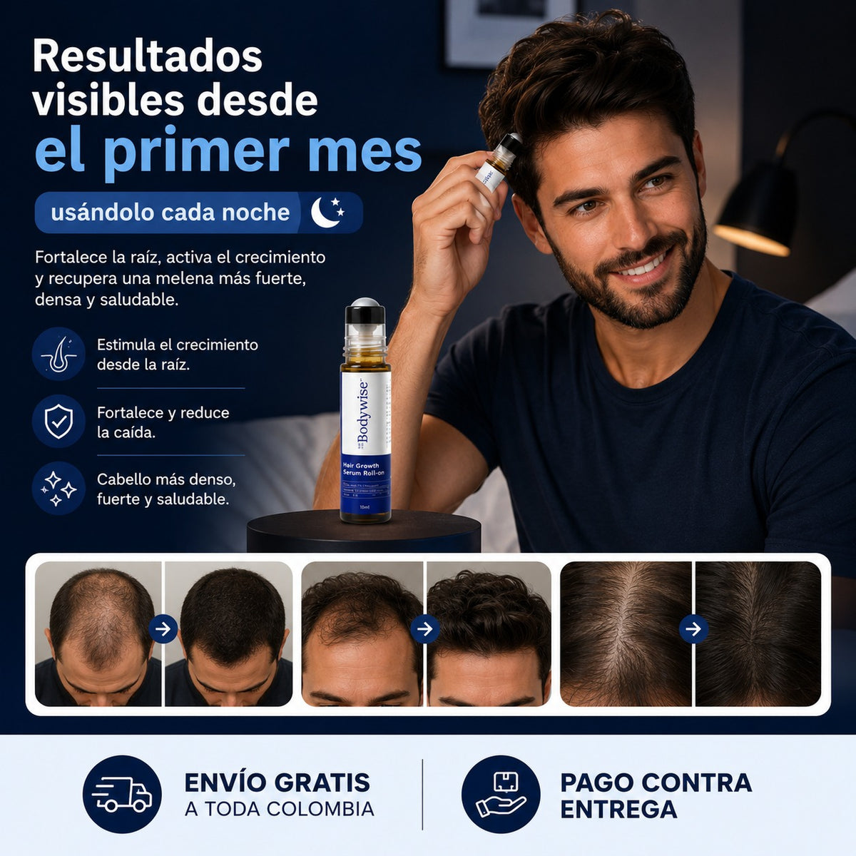 BODYWISE: Recupera esa seguridad que la calvicie te robo