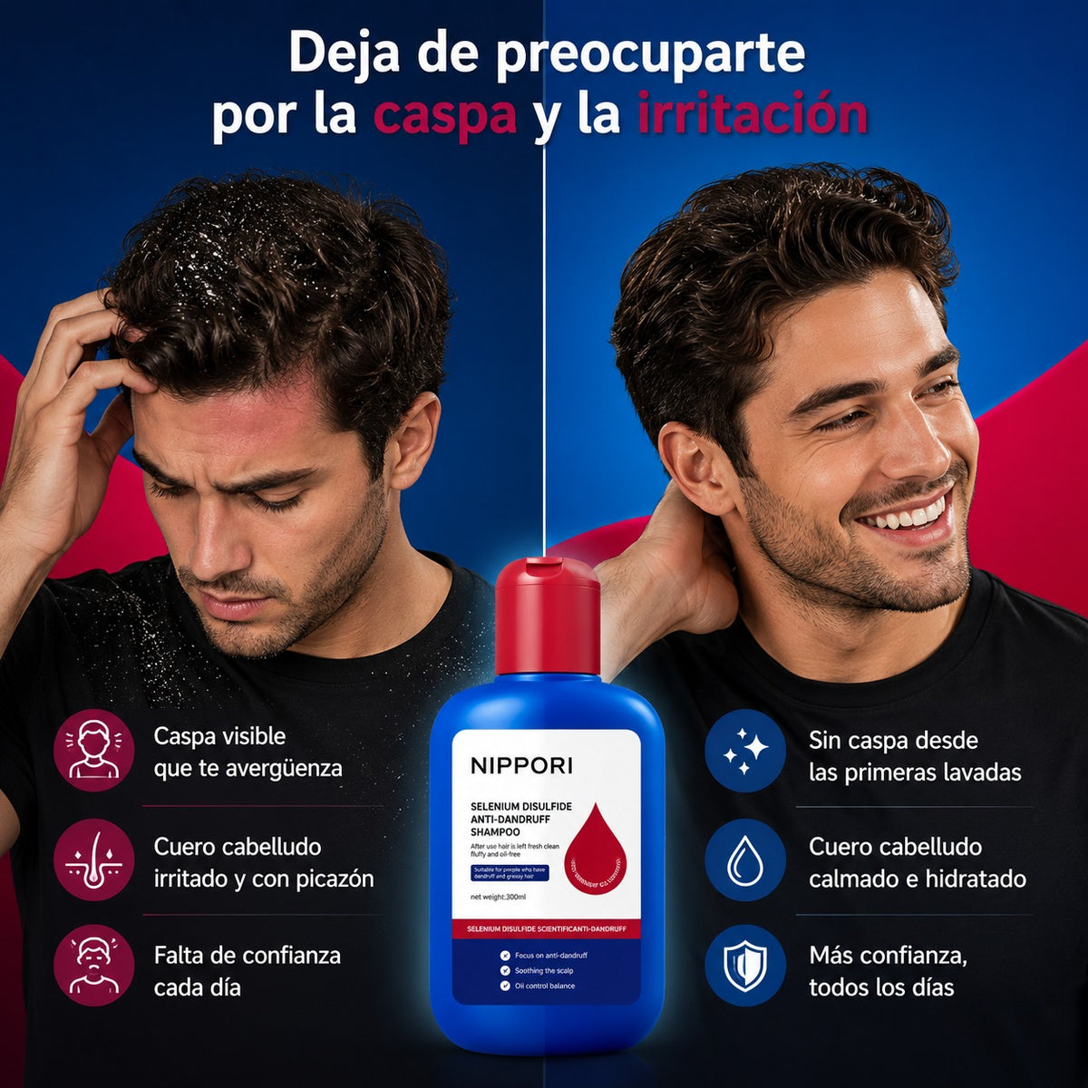 SHAMPOO ANTICASPA: Elimina la caspa y recupera confianza