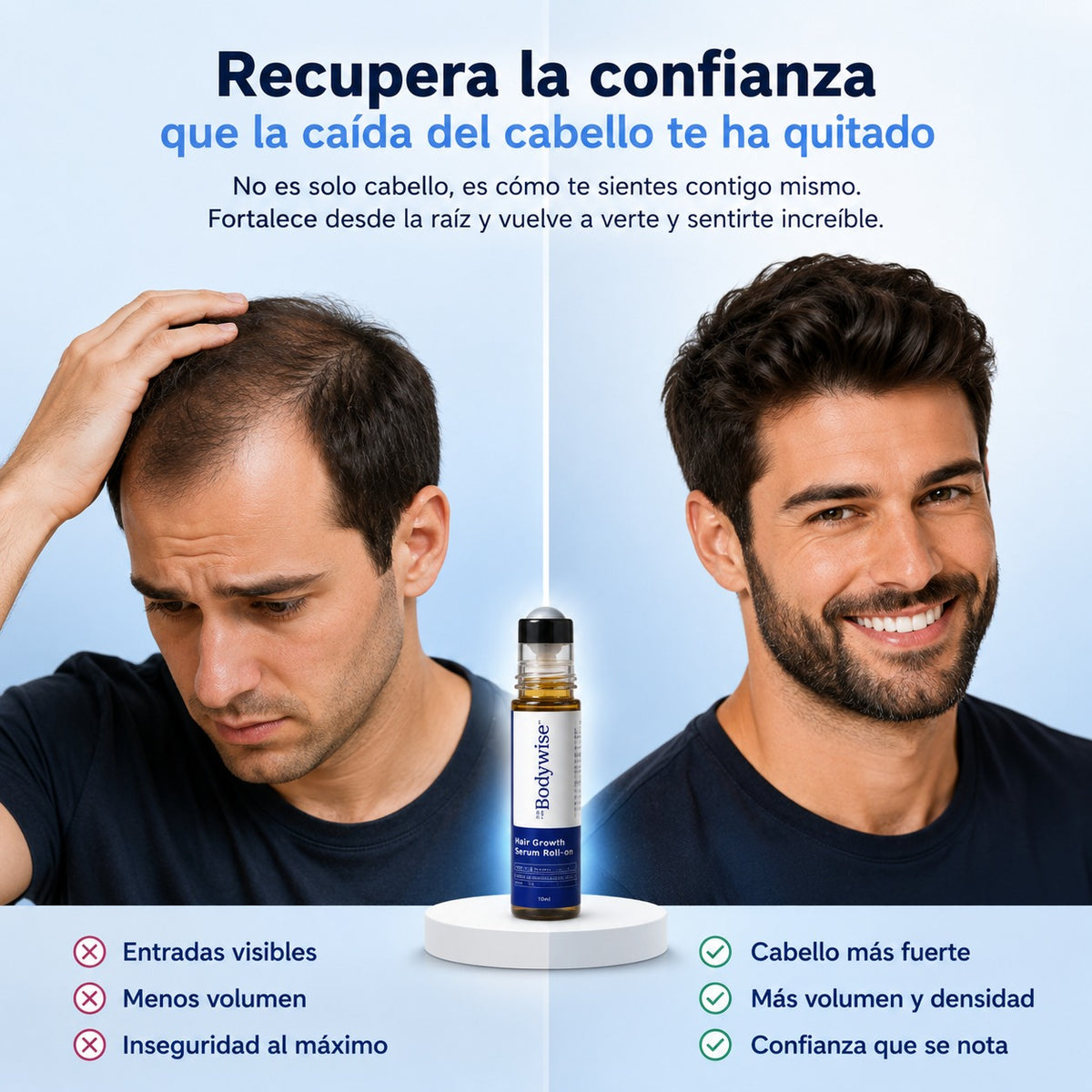 BODYWISE: Recupera esa seguridad que la calvicie te robo